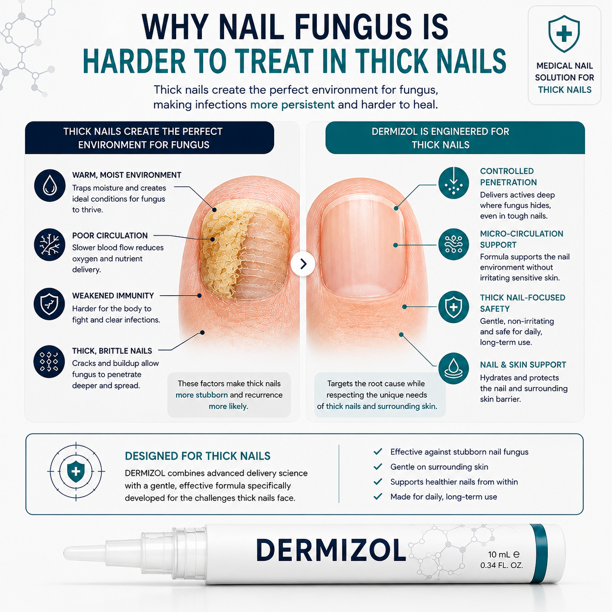 Nail Treatment Pen — For Nails You've Given Up On